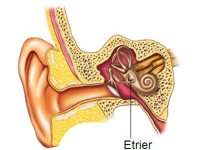 Otospongiose ou blocage de l’étrier congénital chez l’enfant et l’adulte